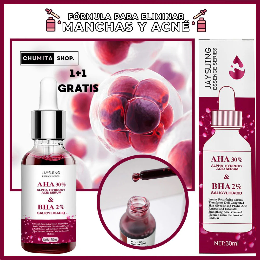 1+1 GRATIS | Serum Natural Anti-acné / Anti-manchas-Chumita Shop.