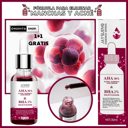 1+1 GRATIS | Serum Natural Anti-acné / Anti-manchas-Chumita Shop.