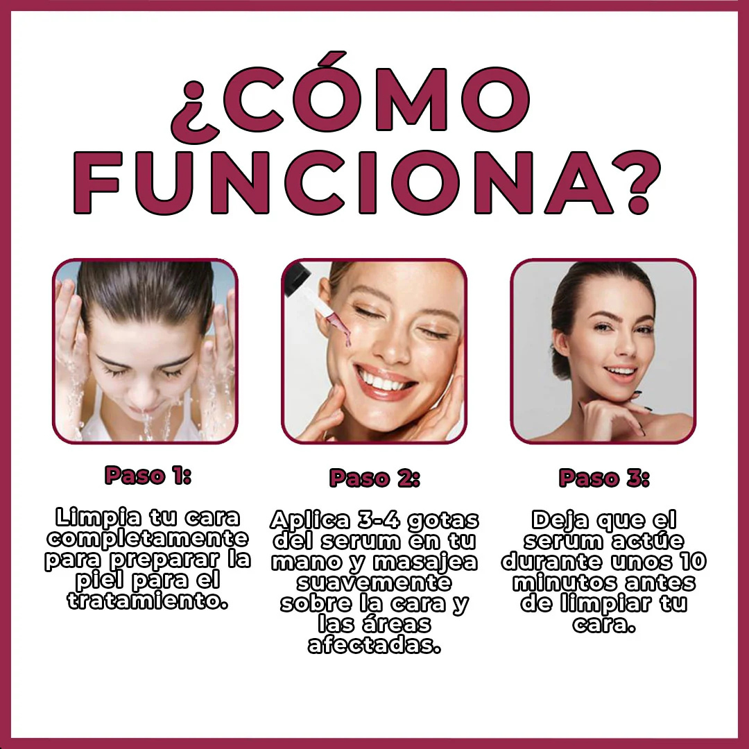 1+1 GRATIS | Serum Natural Anti-acné / Anti-manchas-Chumita Shop.