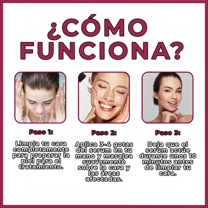 1+1 GRATIS | Serum Natural Anti-acné / Anti-manchas-Chumita Shop.