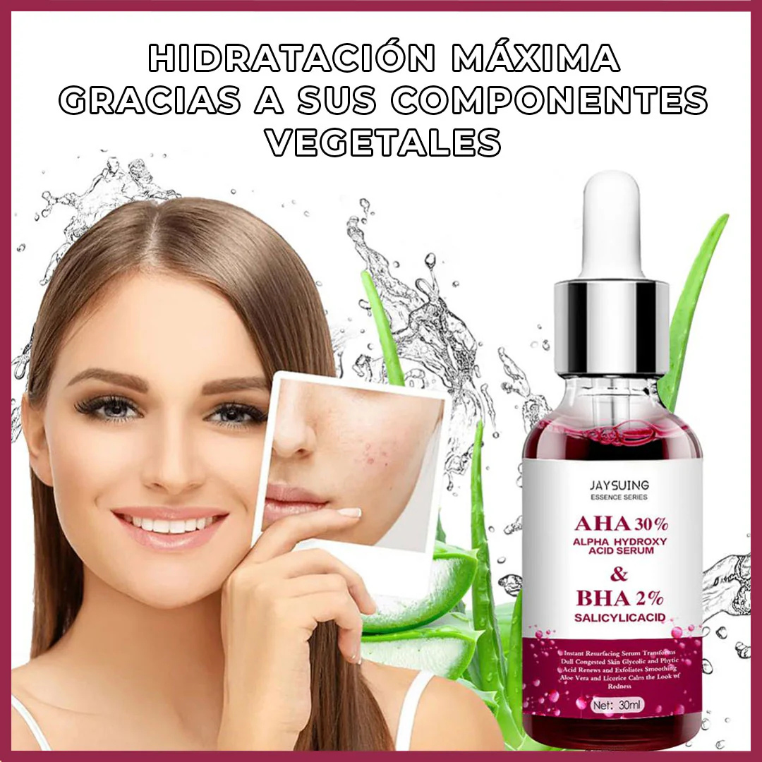 1+1 GRATIS | Serum Natural Anti-acné / Anti-manchas-Chumita Shop.