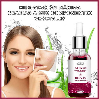 1+1 GRATIS | Serum Natural Anti-acné / Anti-manchas-Chumita Shop.