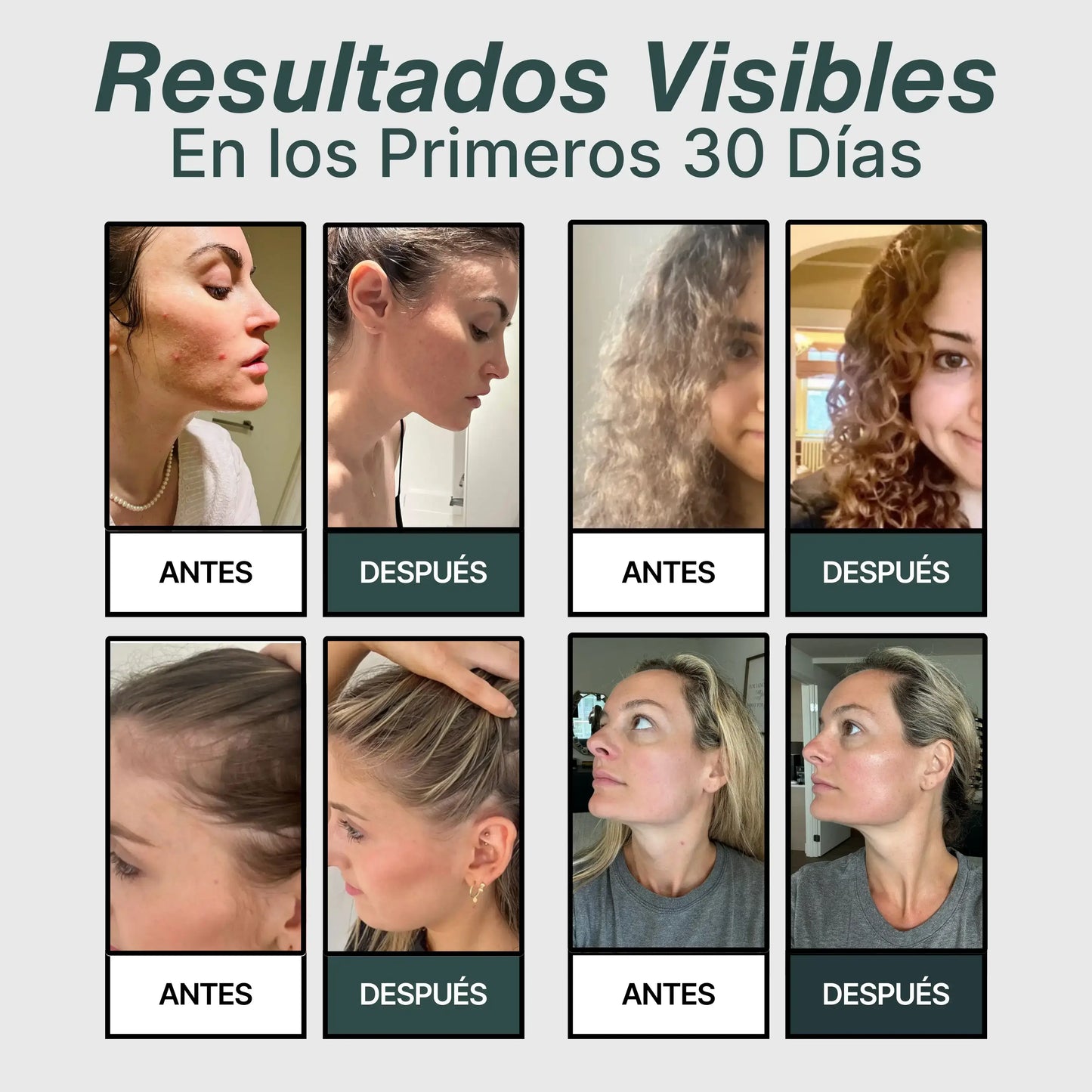 Salva Tu Piel, Tu Pelo y Tu Salud del Desastre con Foral ™ 
