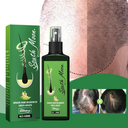 1+1 GRATIS | Growzy™ - Spray con base de jengibre para el Crecimiento del Cabello-Chumita Shop.
