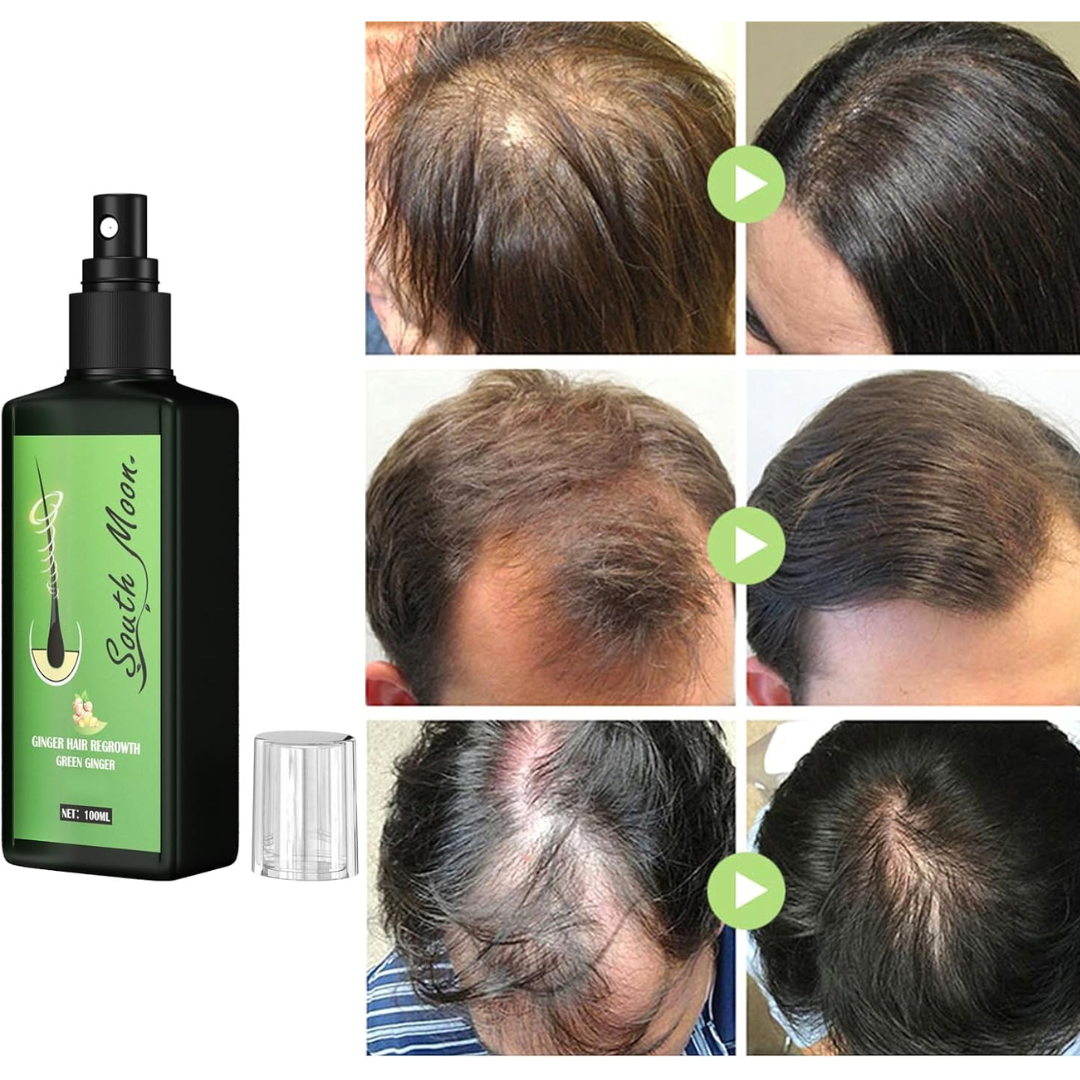 1+1 GRATIS | Growzy™ - Spray con base de jengibre para el Crecimiento del Cabello-Chumita Shop.