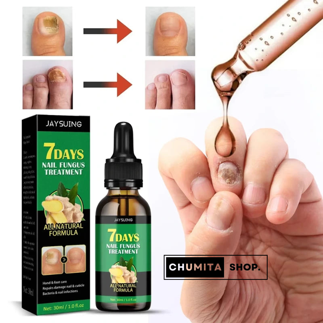 1+1 GRATIS | Biancat™ - Serum de crecimiento y reparación de uñas en 7 días-Chumita Shop.